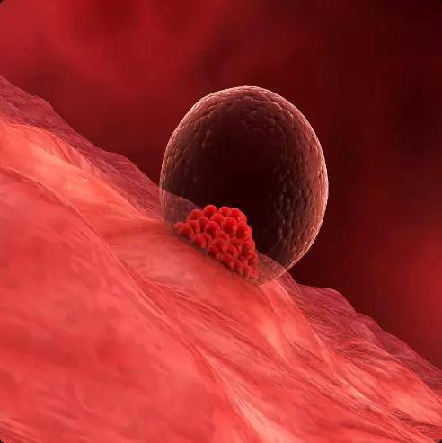 Endometrial Receptivity Array