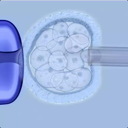 Preimplantation Genetic Diagnosis