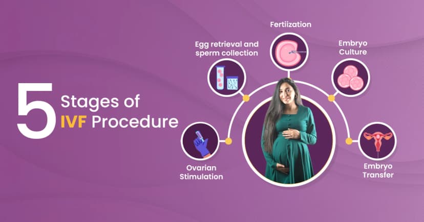 What are the 5 stages of IVF: Step-by-Step Guide image