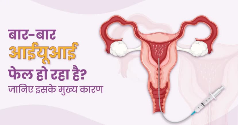 बार-बार आईयूआई फेल हो रहा है? जानिए इसके मुख्य कारण image
