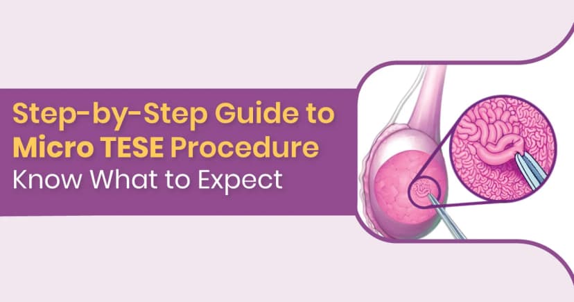 What is the Micro TESE Procedure? A Complete Guide to Sperm Retrieval image