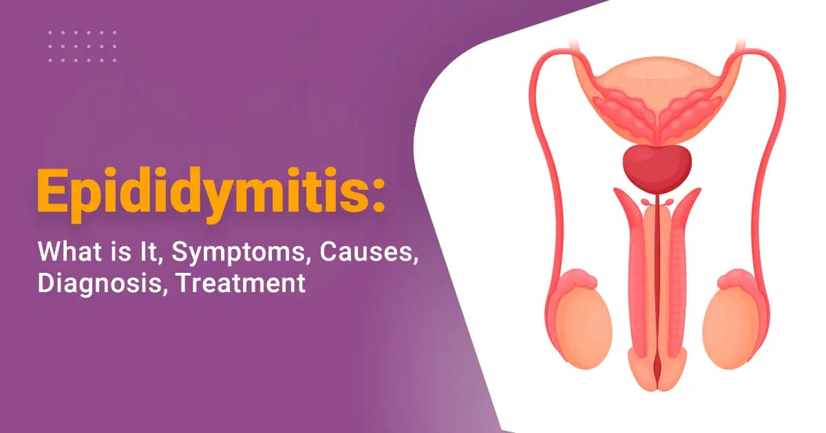What is Epididymitis? Understanding Its Causes, Symptoms and Treatment image