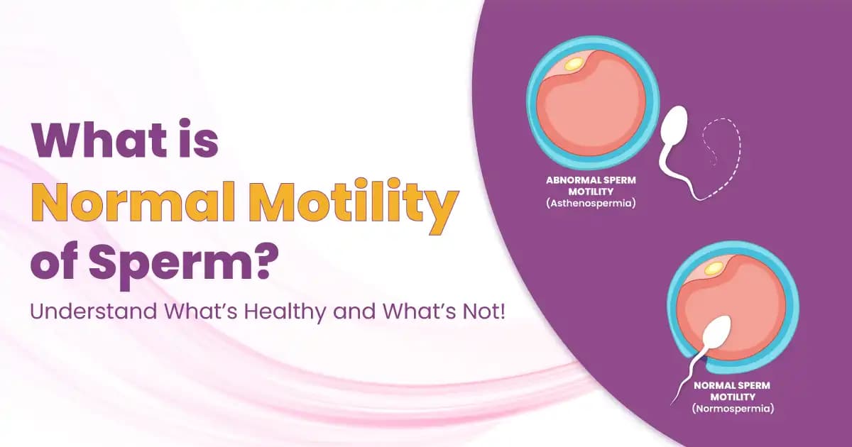 What is the Normal Motility of Sperm? Here’s What You Should Know image