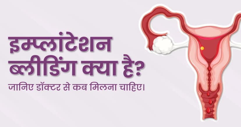 इम्प्लांटेशन ब्लीडिंग क्या है?: लक्षण, कारण, कब डॉक्टर से मिलना चाहिए और उपचार image