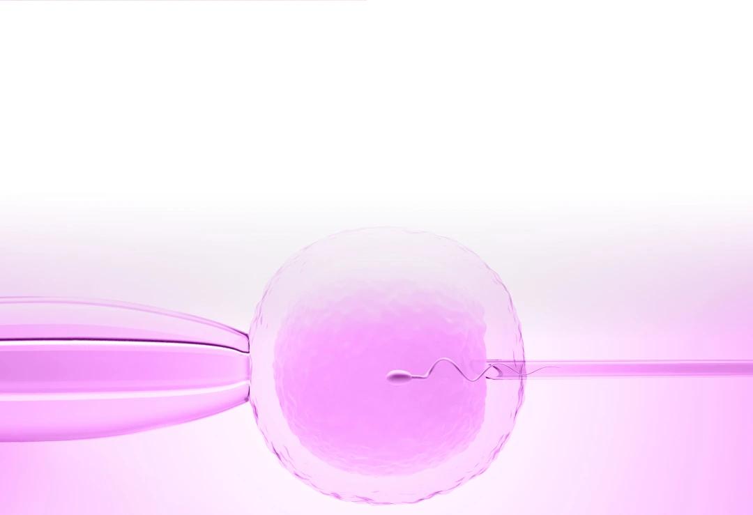 icsi-intra-cytoplasmic-sperm-injection