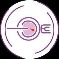 Intra-cytoplasmic Sperm Injection, ICSI treatment in India