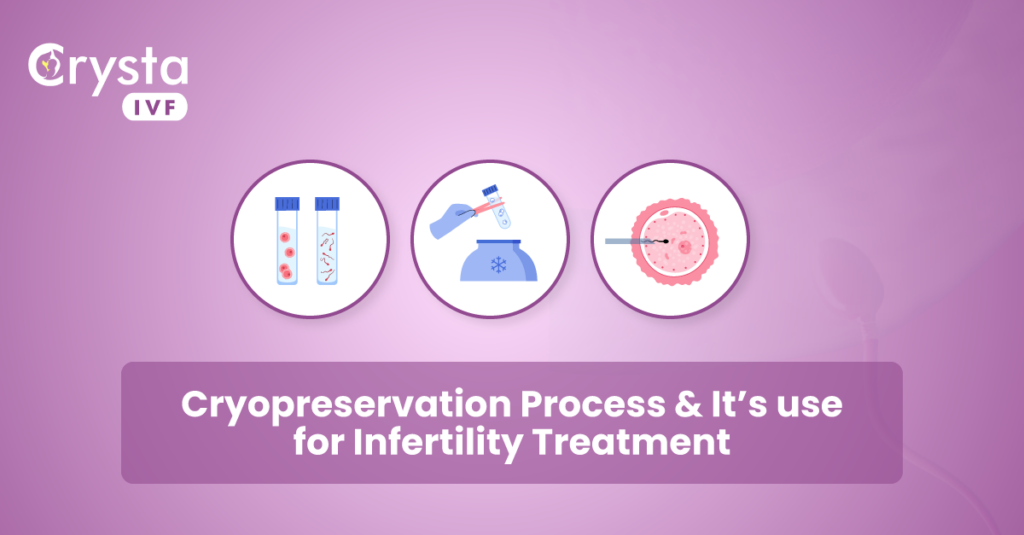 cryopreservation process and its use for infertility treatment
