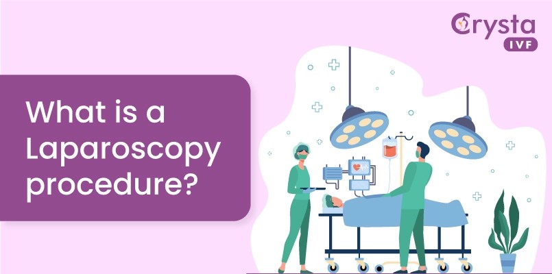 Laparoscopy treatment