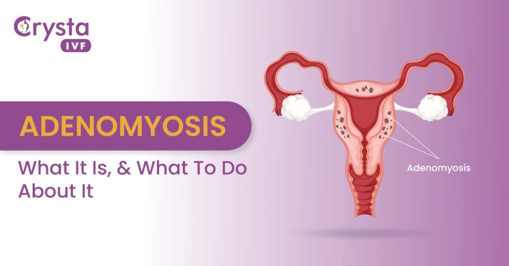Adenomyosis Disease
