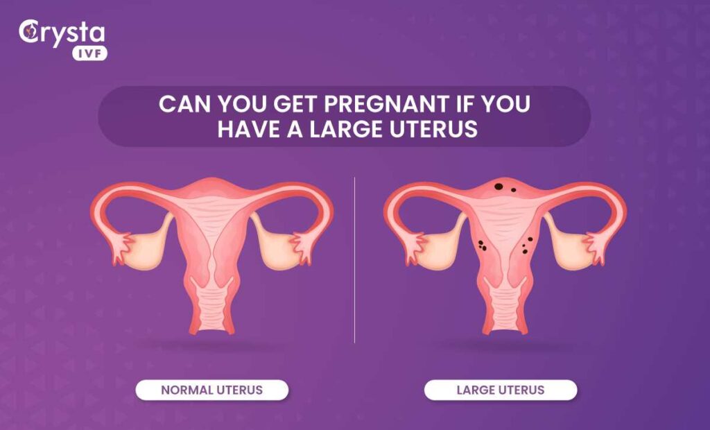 bulky-uterus-meaning-can-you-get-pregnant-with-enlarged-uterus