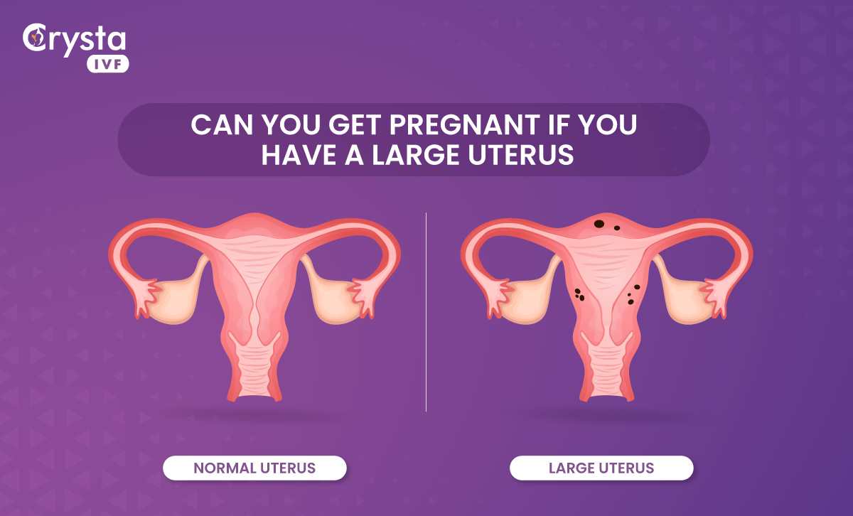 Normal or large uterus
