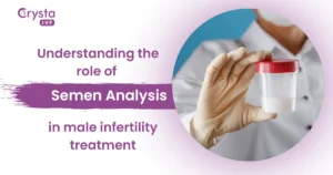 Semen analysis in male infertility treatment