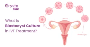 blastocyst culture in IVF