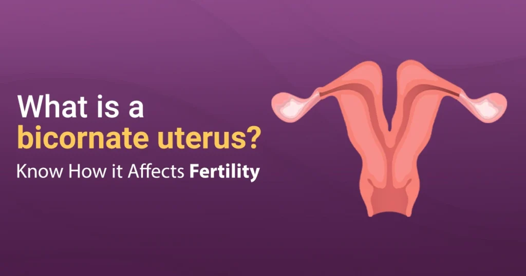 what is bicornuate uterus