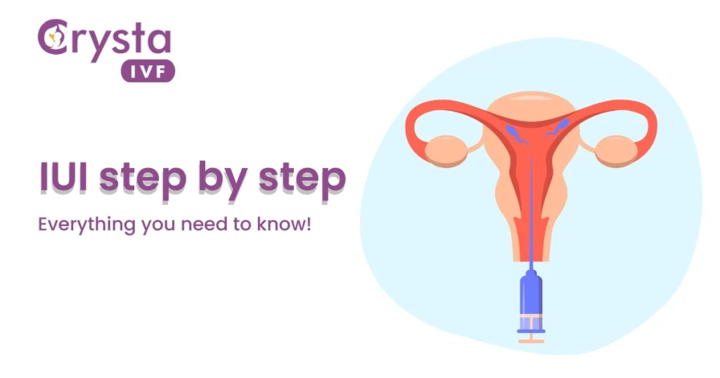 IUI treatment Step by step