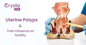 uterine polyps, causes, symptoms, and its Impact on Fertility