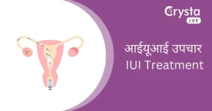 आईयूआई उपचार iui treatment in hindi