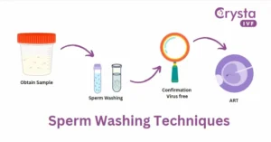 sperm washing techniques