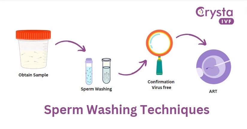 sperm washing techniques
