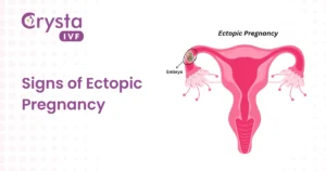 symptoms of ectopic pregnancy