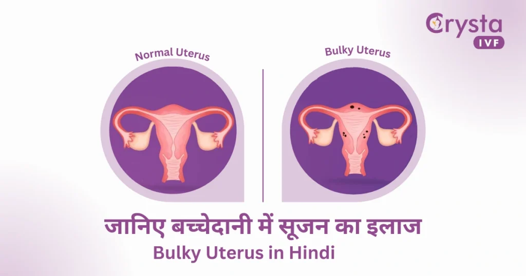 Bulky Uterus in Hindi