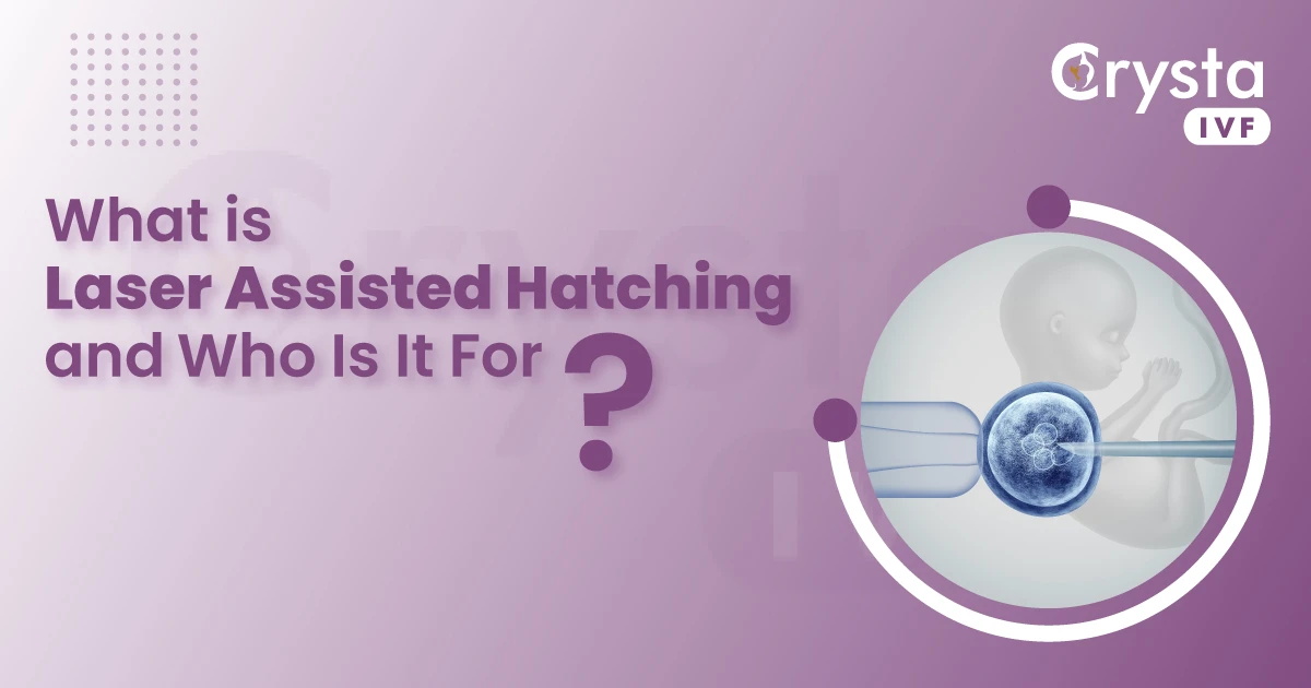 laser assisted hatching