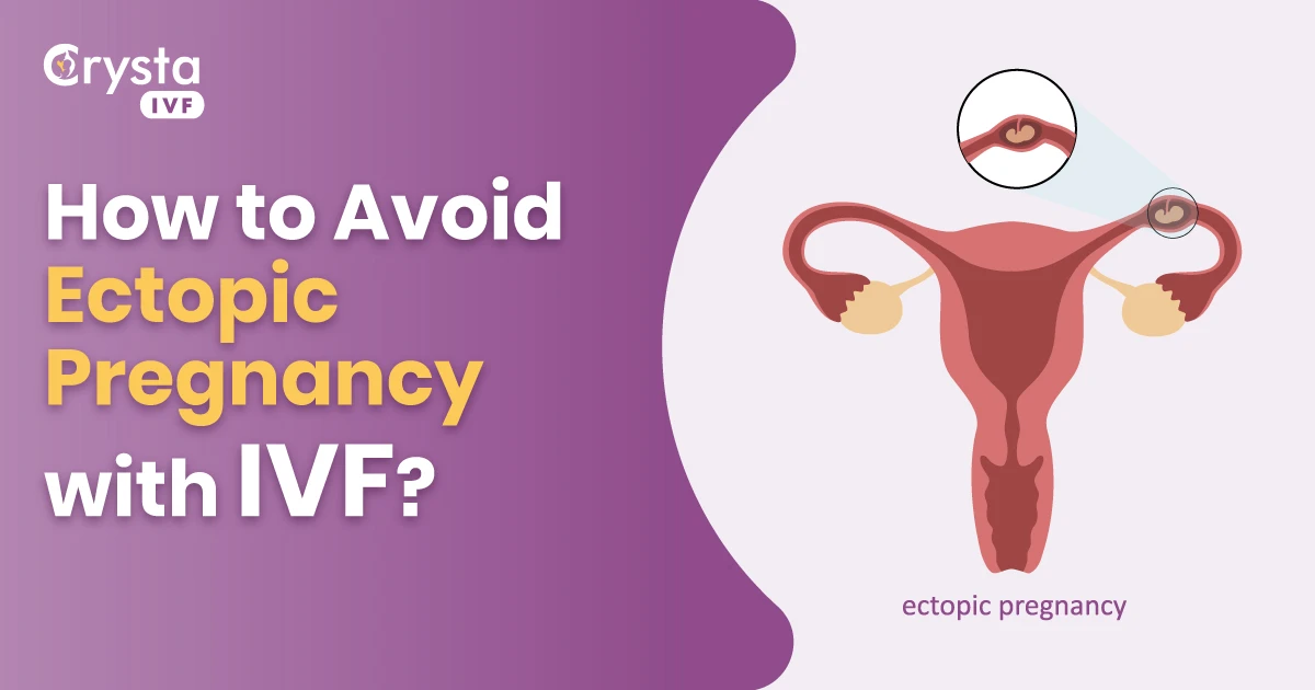 How to Avoid Ectopic Pregnancy