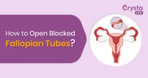 How-to-Open-Blocked-Fallopian-Tubes