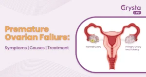 premature ovarian failure