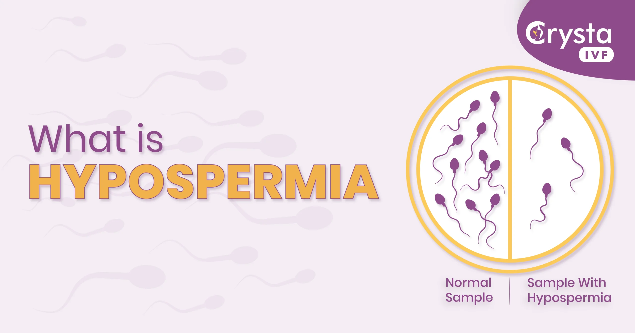 What is Hypospermia? Causes, Symptoms & Treatment