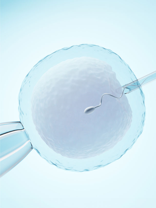 What is IVf