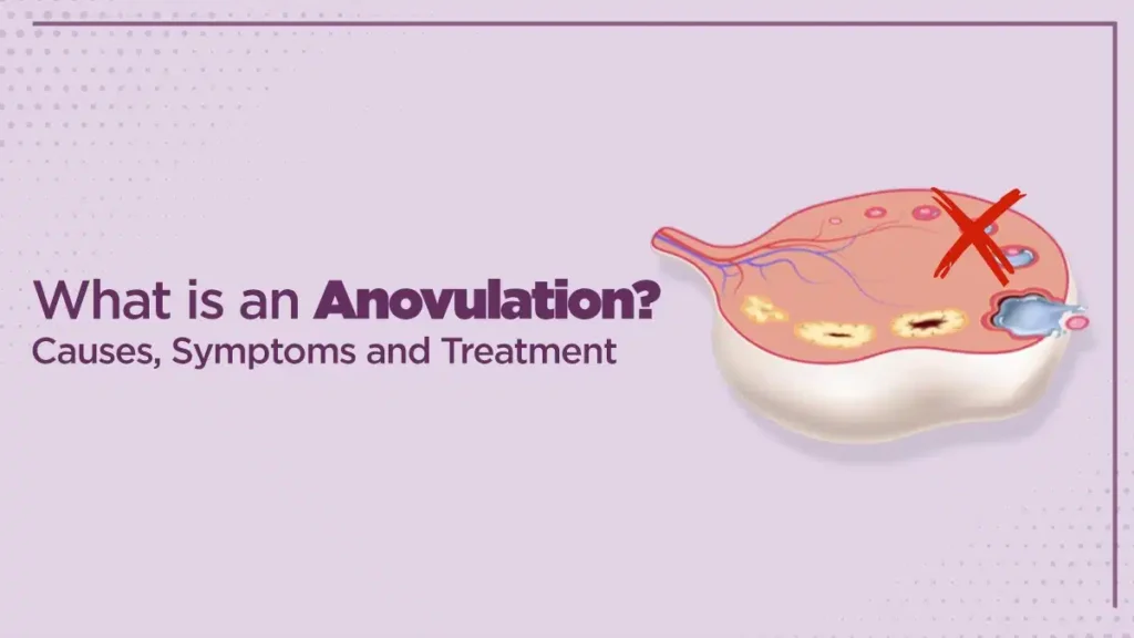 anovulation-causes-symptoms-and-treatments