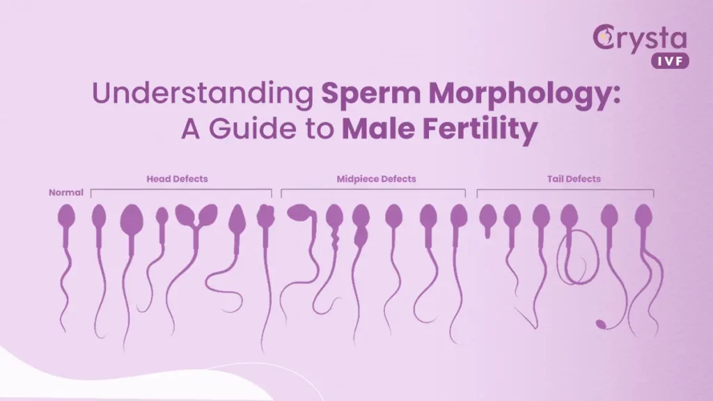 sperm-morphology-male-infertility-complete-guide