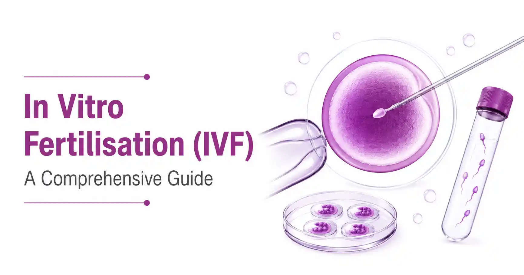 what is ivf, in vitro fertilisation
