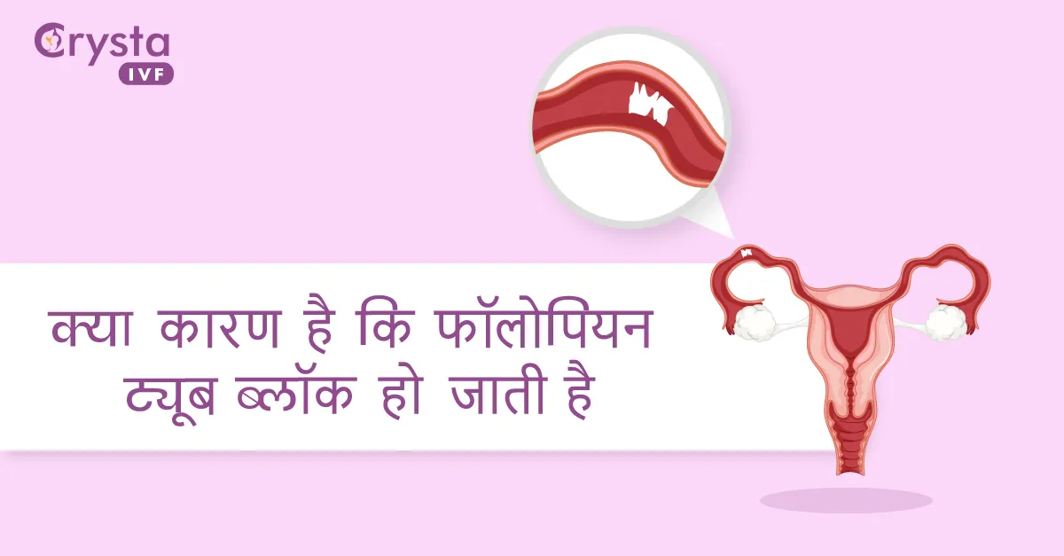 क्या कारण है कि फॉलोपियन ट्यूब ब्लॉक हो जाती है, what causes fallopian tube blockage