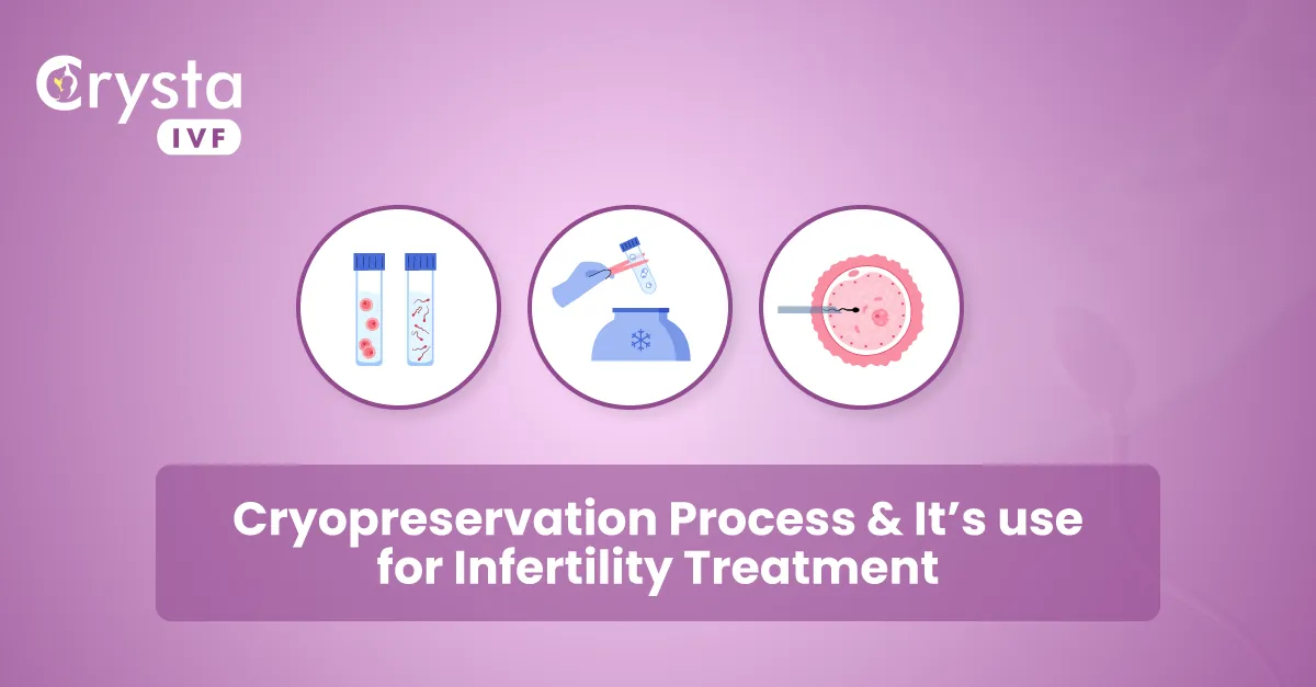 cryopreservation process and its use for infertility treatment
