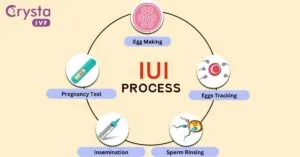 IUI Treatment - Crysta IVF
