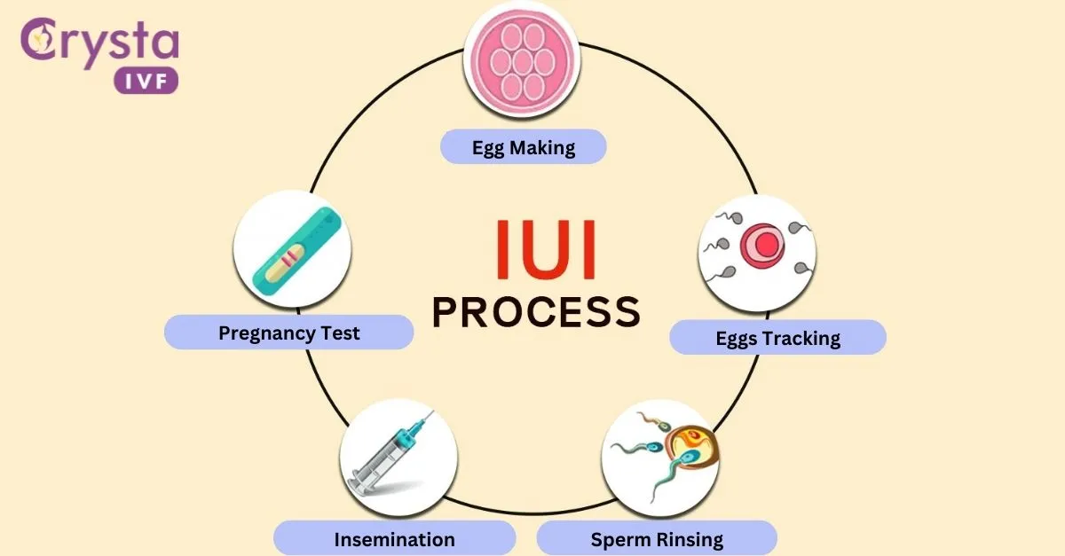 IUI Treatment - Crysta IVF