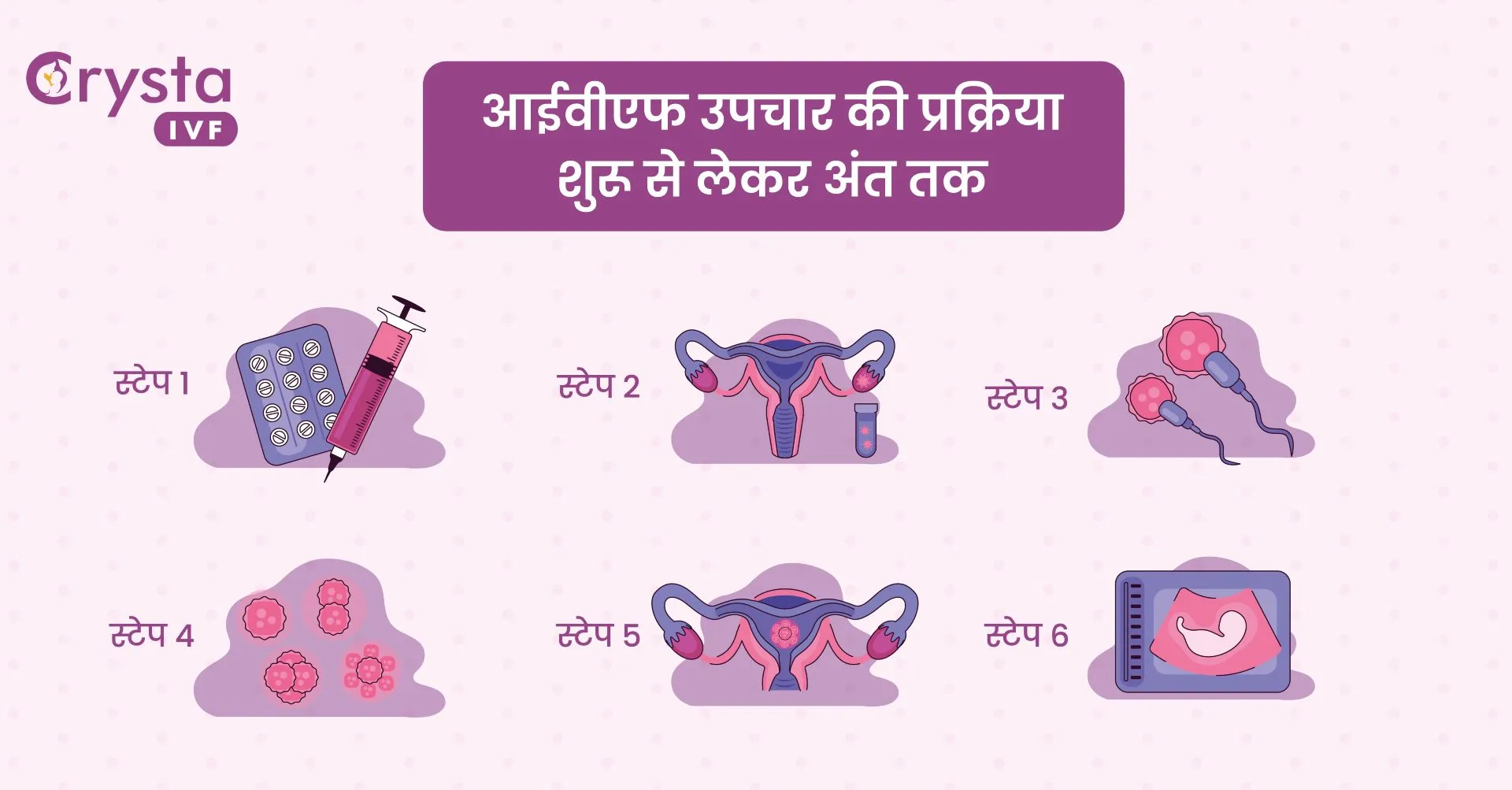 Process of IVF Treatment