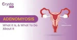 Adenomyosis Disease